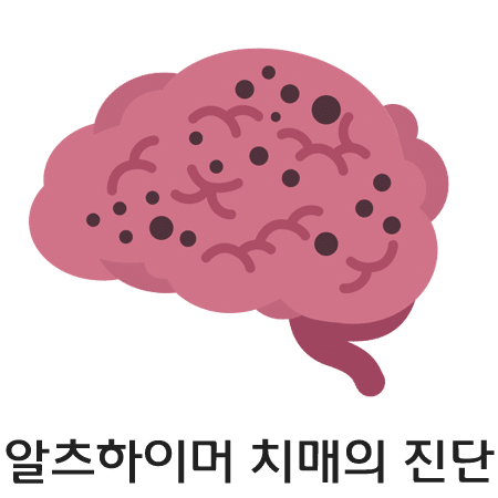 alzheimer-dementia