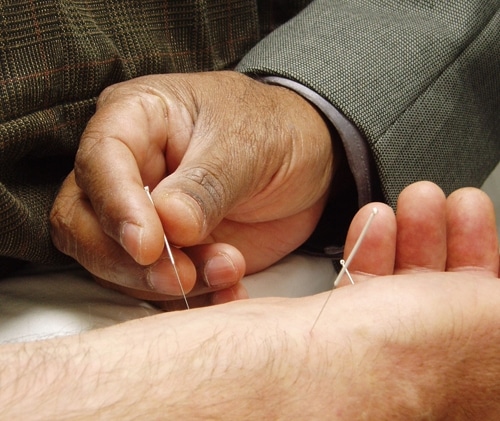 Acupuncture1-1