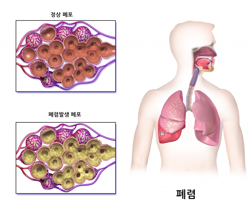 출처 : 위키피디아