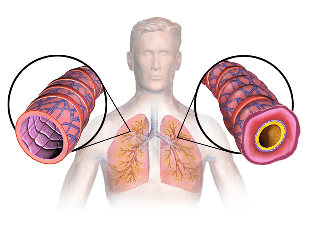 asthma_lungs