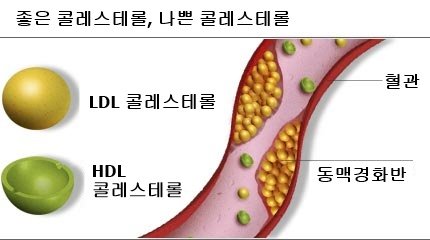 cholesterol
