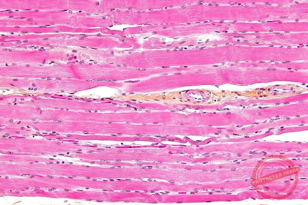 Skeletal_striated_muscle
