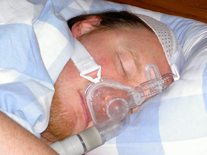 CPAP, 지속적 양압 호흡기