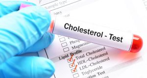 콜레스테롤 혈액검사