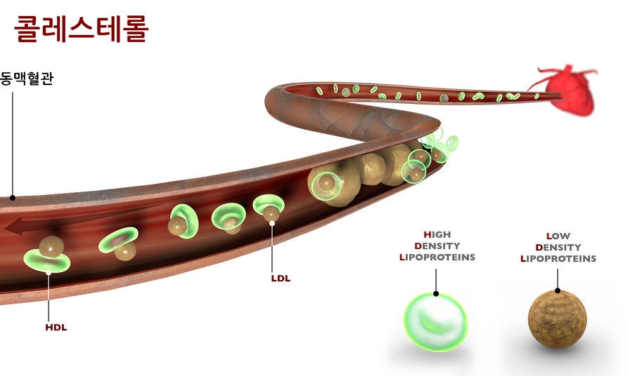LDL,HDL 콜레스테롤